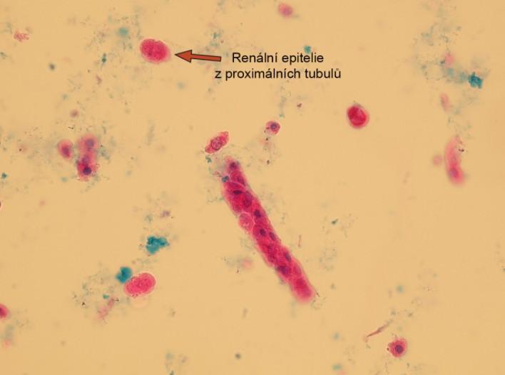 RENÁLNÍ TUBULÁRNÍ EPITELIE : Renální tubulární epitelie jsou polyedrické (mnohostěnné) buňky s