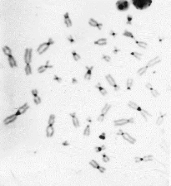 Barvení heterochromatinu C-pruhy silná denaturace euchromatinových částí: HCl, BA(OH)2 + solné rotoky za vyšší teploty, Giemsou