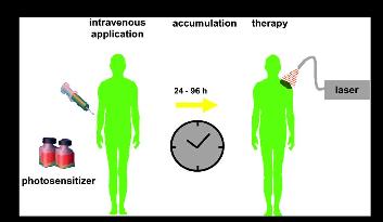 3.3 Princip PDT Pro účinnost fotodynamické terapie jsou potřeba tři složky fotosenzitizér, látka, která se podává pacientovi a je schopna absorbovat světlo určitých vlnových délek a přetvářet jej na