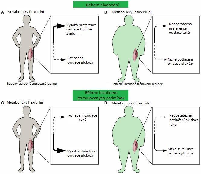 (upraveno podle Kelley 2005) Obr.3. Metabolická flexibilita organismu Flexibilita svalu souvisí s citlivostí organismu k inzulínu, množstvím tělesného tuku a tělesnou kondicí.