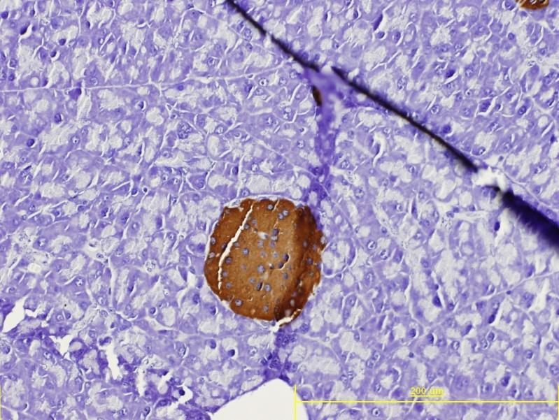 ostrůvků pankreatu u jednotlivých skupin myší z hlediska velikosti