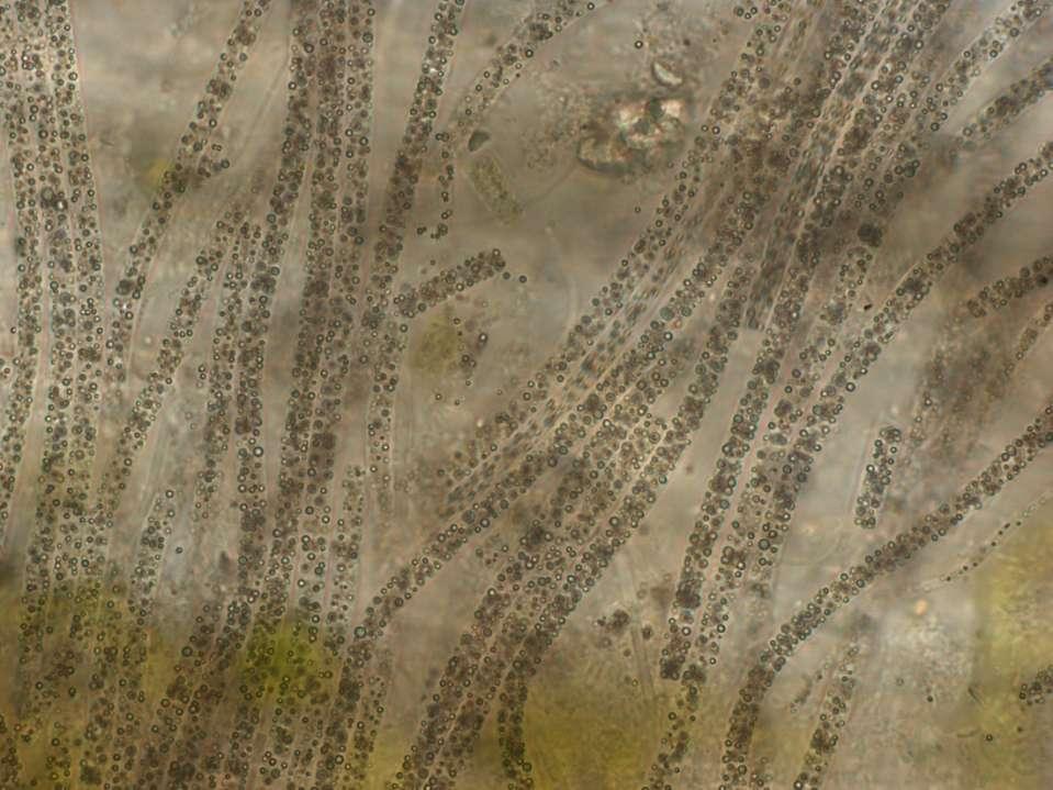 Sirné bakterie rodu Beggiatoa