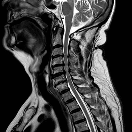 Symptomatická diagnostika Odvíjí se od