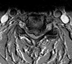 kanálu Clinical imaging mismatch - rozpor zobrazovacích metod a