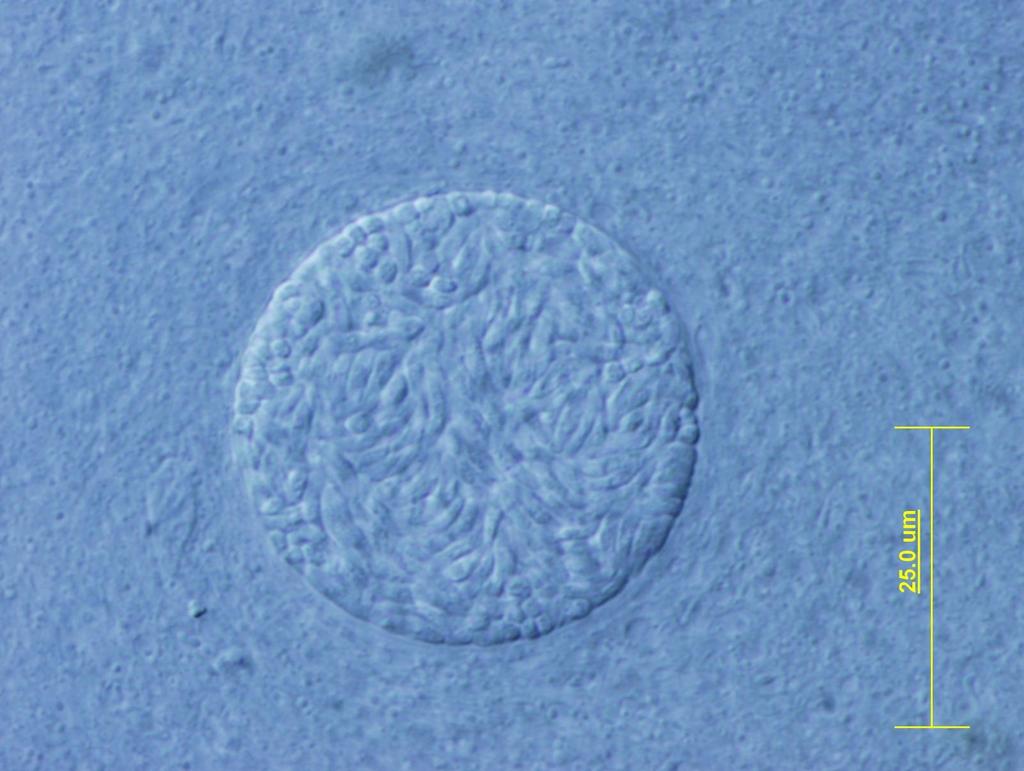 Toxoplasma gondii tkáňová cysta v