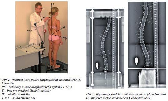 Dotykové metody Dotykové metody fungují na základě snímání určitých označených bodů na těle prostřednictvím dotykového zařízení, které pracuje na principu elektromagnetickém či elektromechanickém.