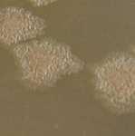 Pravidelný okraj Klebsiella ozanae