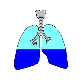 hydrothorax, plicní fibróza, deformity hrudníku, porucha