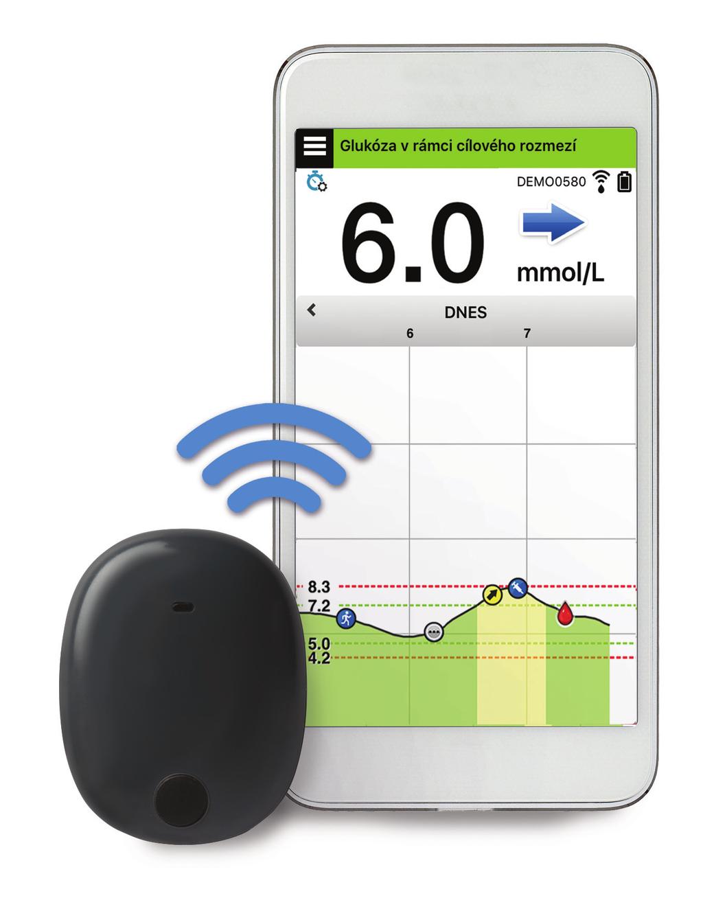 Systém pro kontinuální sledování hladiny glukózy Stručná referenční příručka Váš systém CGM Eversense XL obsahuje senzor, který se zavádí do paže, vysílač Smart, který se umístí do