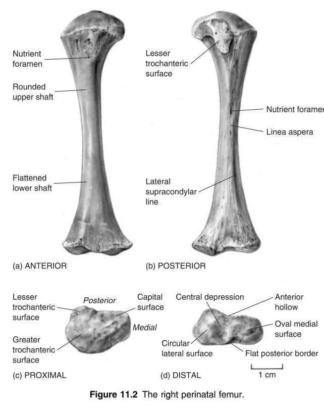 Femur