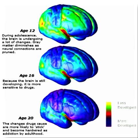 Mozek a adolescence Propojení mezi frontálními laloky a ostatními částmi mozku se dokončují až v dospělosti.