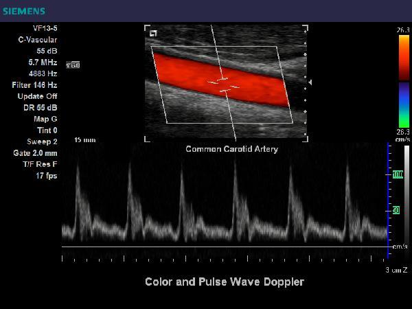 http://stroke.ahajournals.org/content/strokeaha/32/4/836/f1.