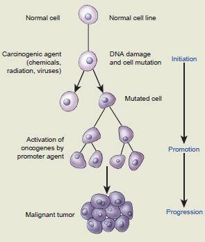 stadia iniciace expozice karcinogennímu agens