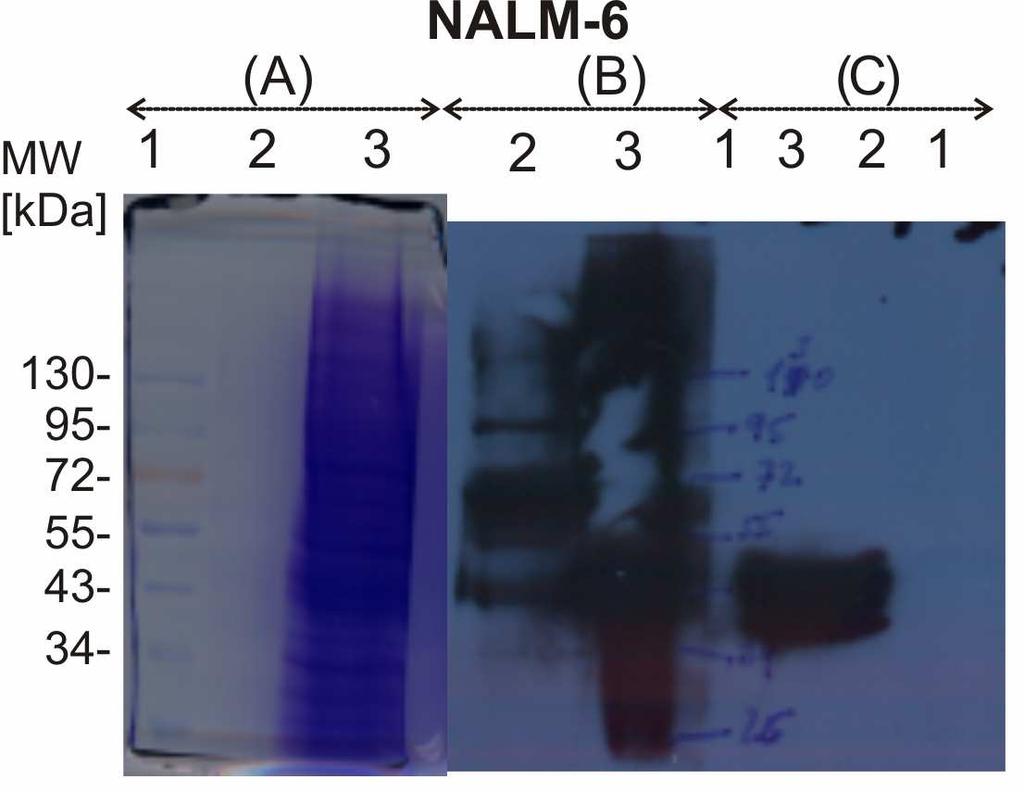Obr. 4.16. Porovnání barvení gelů roztokem Coomassie Brilliant Blue R250 (A) s ECL vizualizací (B) u dvou linií SUP-B15 (nahoře) a NALM-6 (dole).