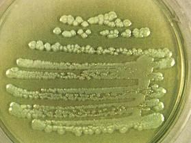 3. Gramnegativní nefermentující bakterie Bylo nevlídno, že by PSAE ven