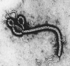 Virus Ebola http://vietsciences.free.