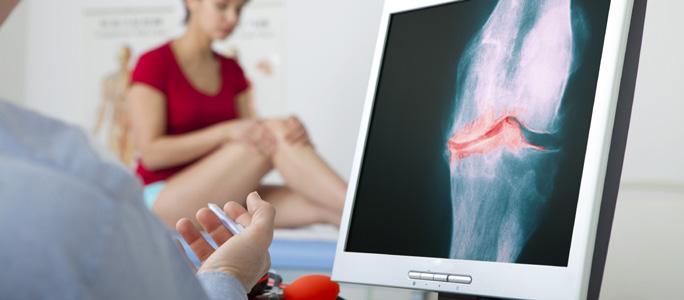 BI THERAPEUTICS kazuistiky Tři kazuistiky z praxe MUDr. Marka Petráše GONARTRÓZA Diagnóza: Oboustranná gonartróza, vpravo dekompenzovaná, vertebroalgický syndrom LS páteře.