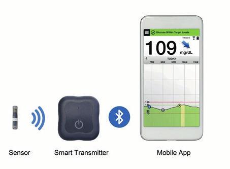 Senzor Smart Transmitter Eversense Mobile app diasend Web aplikace 1