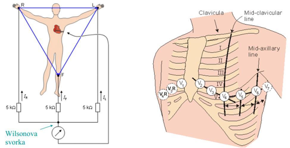 Obr. 3 Vlevo: vytvoření Wilsonovy svorky; vpravo: umístění elektrod hrudních svodů [3] Obvykle bývá měřeno jen 8 svodů (I, II, V1 až V6), napětí ostatních 4 svodů (III, avr, avf, avl) se dají