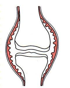 Patologická anatomie 1.