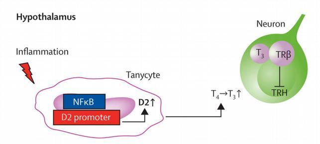 Zánět zvyšuje aktivitu D2 v tanycytech 3.