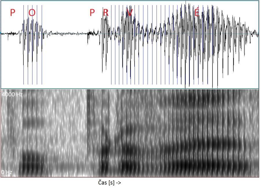 Artikulace: formanty Základní hlasivková frekvence: 50 400 Hz (muži 50 200Hz, ženy 150 400 Hz) Rezonanční frekvence (velikost frekvence závisí na samohlásce a pohlaví): F1: 460 1100 Hz (pohyb jazyka