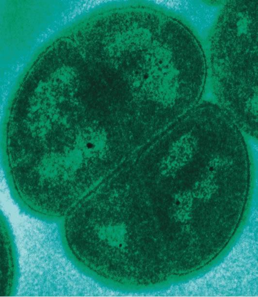 Zajímaví živočichové/rostliny Deinococcus radiodurans bakterie Přežije i 10 000x