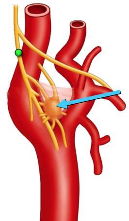 pao 2 aktivace perif. chemoreceptorů karotická tělíska n. glosofaryngeus aorta n.