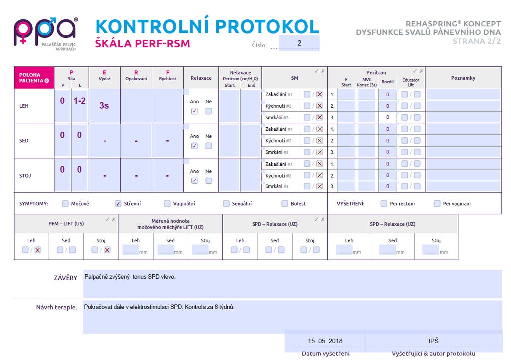 Kontrola