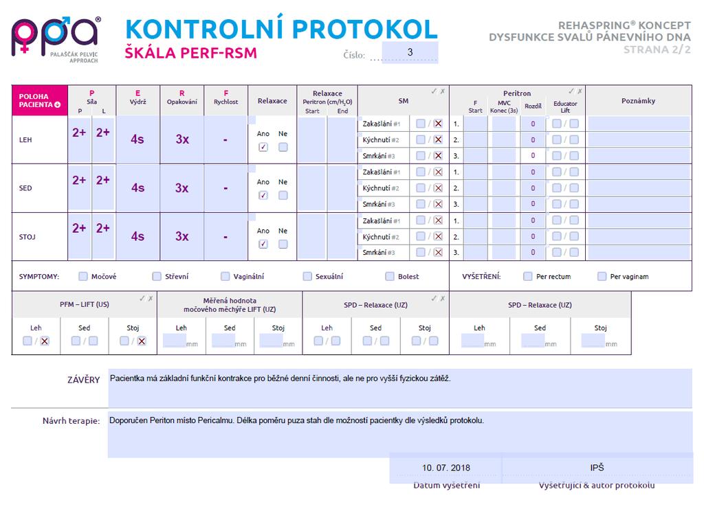 Kontrola