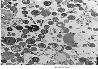 Bakterie BEZ buněčné stěny přirozeně mykoplazmata nesyntetizují peptidoglykan nejmenší bakterie (0,2 µm) původci onemocnění plic ztráta během života = tzv. L-formy bakterií tj.