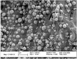 u rodu Pseudomonas Biofilm společenství mikroorganismů obalené extracelulární polymerní matrix (tvořeno hlavně z polysacharidů; slizová hmota)