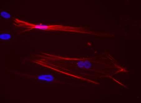 Differentiation of human epidermal neural crest stem cells