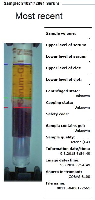 Jako hraniční byly určeny hodnoty sérových indexů SIH = 20 μmol/l, SIH = 100 μmol/l, SII = 60 μmol/l a SIL = 35 μmol/l. Minimální počet vzorků na kategorii byl 50.