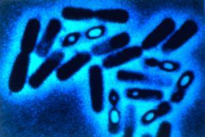 Charakteristika G+ tyčinek - bacily G+ mohutné tyčinky s rovnými konci Pohyblivé, sporulující - jedna endospora (terminální, subterminální či centrální) Kataláza POZ Většina zástupců neškodné mikroby