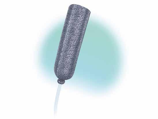 Eso-SPONGE Endoluminální vakuová terapie insuficience anastomóz v horní části gastrointestinálního traktu Dehiscence anastomózy nebo jiné defekty v horní části trávicího ústrojí mohou mít pro