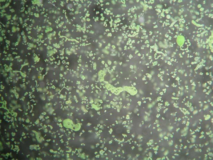 Microcystis spp.