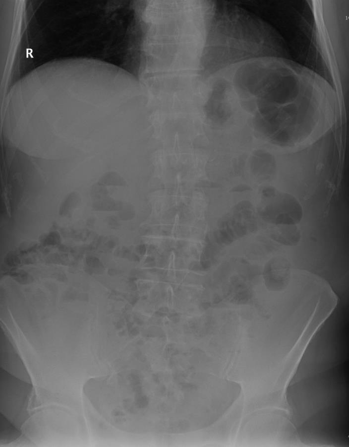 Case 1: 73 letá pacientka přichází na chirurgickou ambulanci s 1 den trvající bolesti v