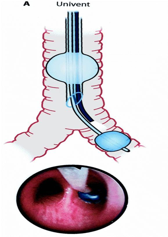 Bronchiální