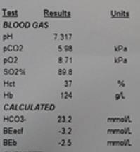 DO 2 a VO 2 v praxi 1. Makrohemodynamika 2. Mikrohemodynamika: Scvo 2, laktát 3.