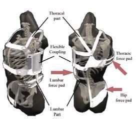 Obrázek 11: Ortéza Tria-C Zdroj: Fisk et al.,2017, str. 132 SpineCor ortéza Poprvé byla SpineCor ortéza popsána Charlesem Rivardem a Christine Coilardovou v Montrealu roku 1998.