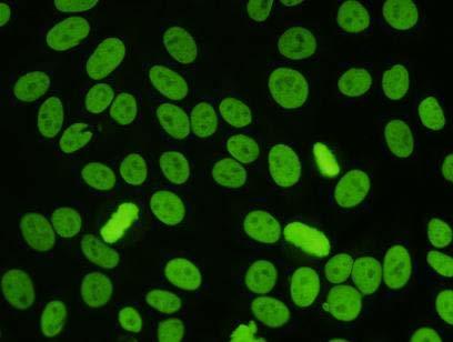 Substrát: HEp-2 Metoda: IFA  9 ANA,