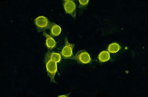 Substrát: HEp-2 Metoda: IFA  11 ANA,