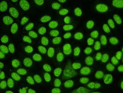 membrány Substrát: HEp-2 Metoda: IFA 