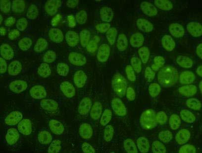 Substrát: HEp-2 Metoda: IFA  19 ANA,