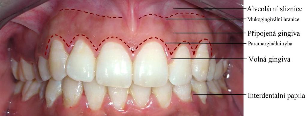 Okraj dásně probíhá přibližně 0,5 až 2 mm od cemento-sklovinné hranice zubů v koronárním směru.