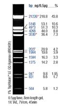 DNA/EcoRI+Hind III (FERMENTAS). Rozdělený PCR produkt byl vizualizován na UVP transiluminátoru (UVP transilluminator). Výsledek byl fotograficky zdokumentován digitální kamerou UVP.