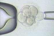 choroby), nebo chromozomové aberace (translokace, inverze, atd.