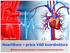 HeartWare práce VAD koordinátora Centrum kardiovaskulární a transplantační chirurgie Brno