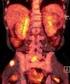 Pokroky ultrasonografie v diagnostice nádorů ledvin